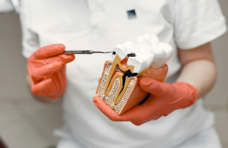 caries revitalisation pulpaire - Endodontie