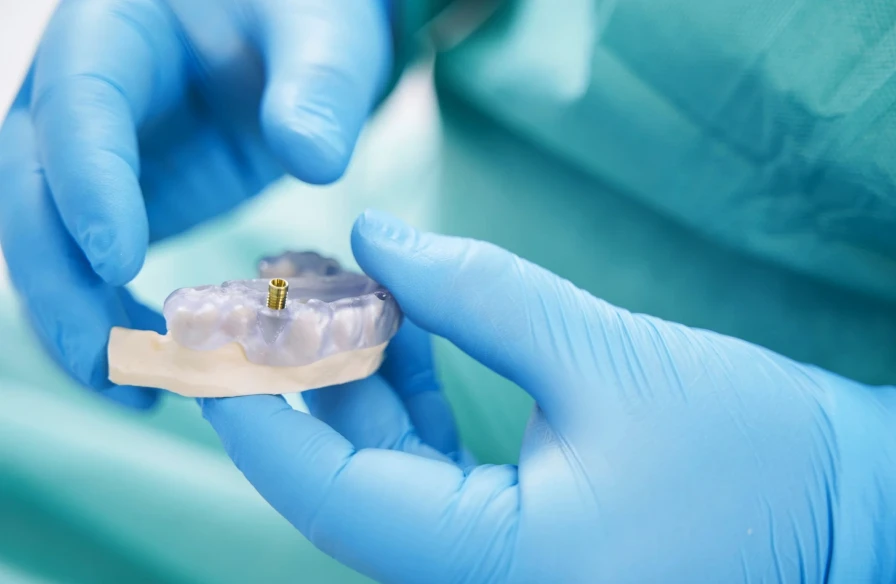chirurgie dentaire guidee dentiste kouassi - Implantologie