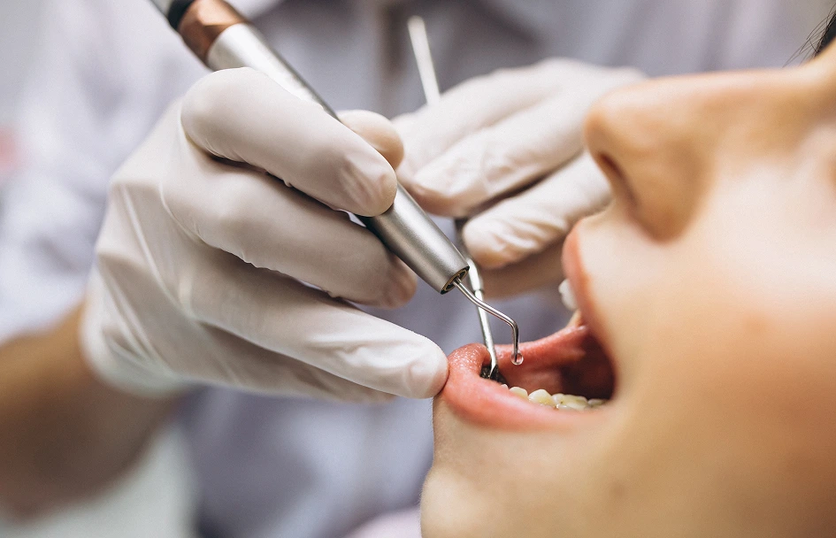 gradient therapeutique dentisterie kouassi - Gradient thérapeutique - République du Sourire | Dr Kouassi