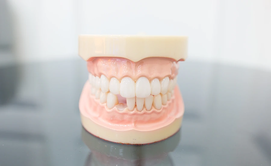 Perte de dents