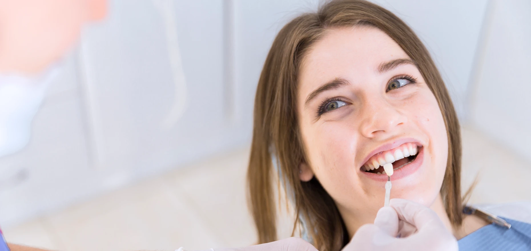 pose facette dentiste kouassi - Esthétique