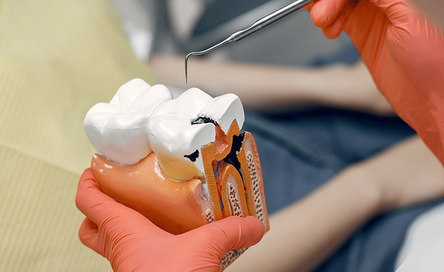Pendant le traitement endodontique